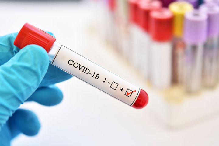 Azərbaycanda koronavirusa yoluxma statistikası açıqlandı