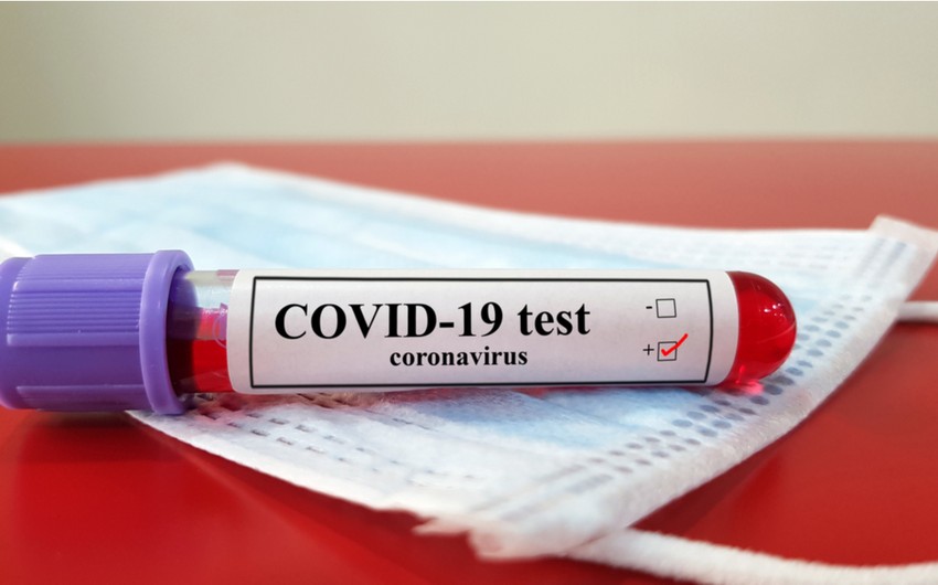 ÜST dünyada koronavirusdan ölənlərin sayını açıqladı