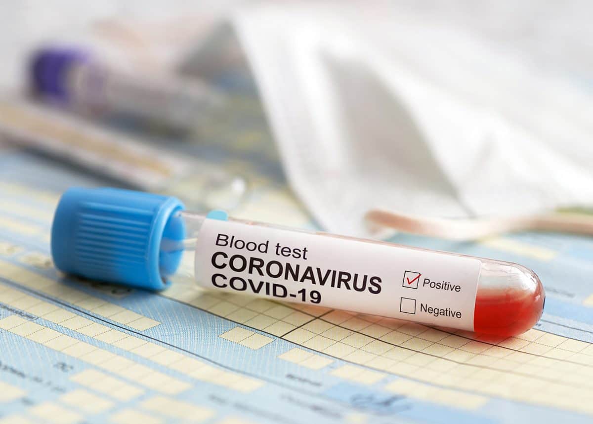 Bakıda 5 müəllim və 1 uşaqda koronavirus tapıldı