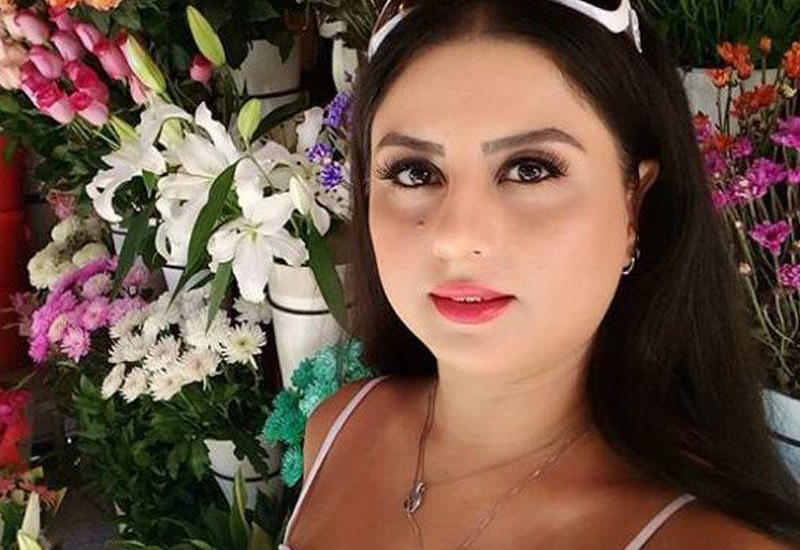 Azərbaycanlı aktrisa əməliyyatla arıqladı - FOTO