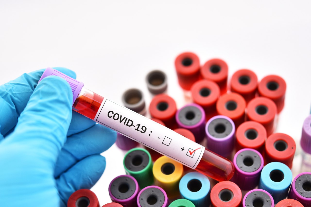 GÜNLÜK STATİSTİKA: Daha 37 nəfər koronavirusdan öldü