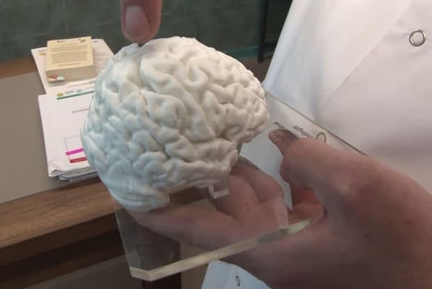 Türkiyədə 3D printerlə insan beyninin nüsxəsi hazırlandı - VİDEO
