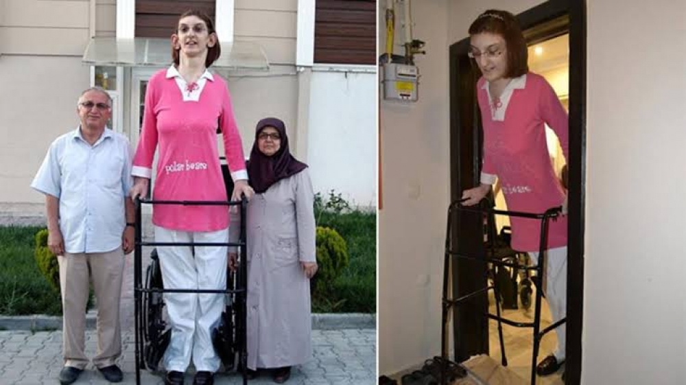 Türkiyənin ən uzun boylu qadını “Ginnesin rekordlar kitabı”na düşdü