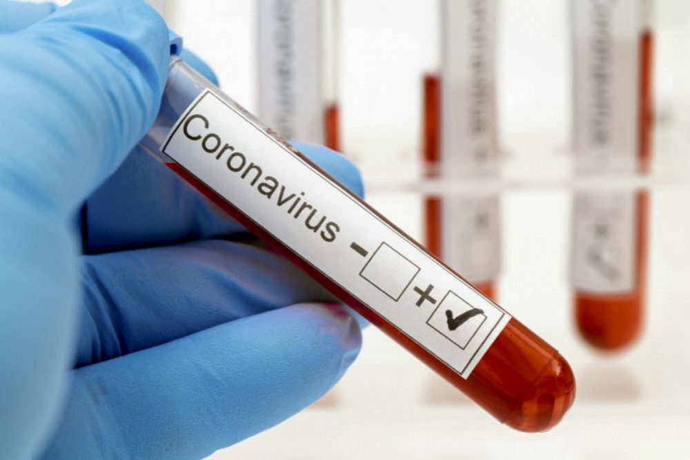 Dünyada daha 555 min nəfər koronavirusa yoluxdu