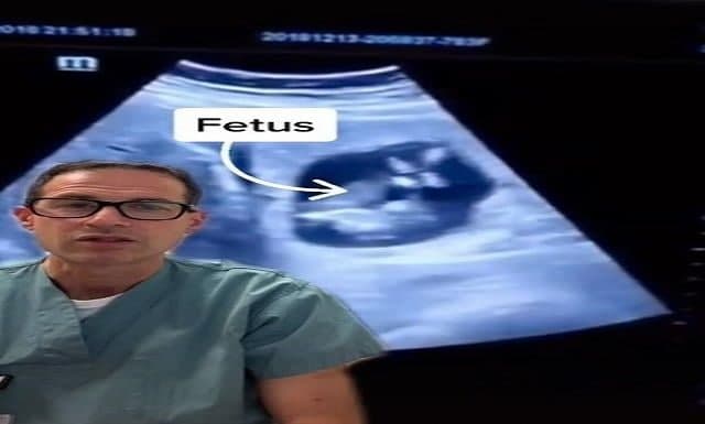 Qadının qaraciyərində ölmüş döl aşkarlandı