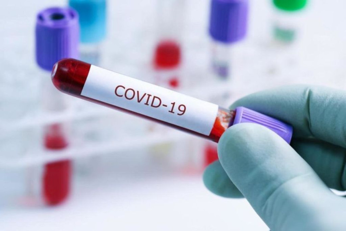 Dünyada koronavirusa yoluxma sayı azaldı