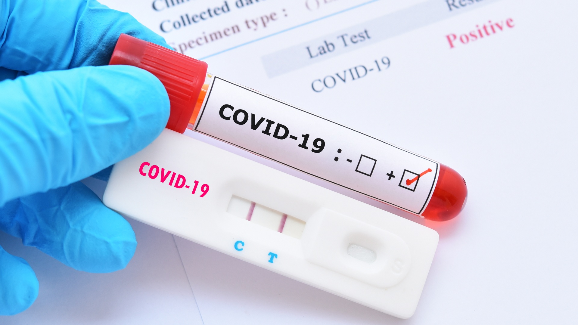Koronavirusun təyin edilməsində hansı testlərin effektivliyi yüksəkdir?
