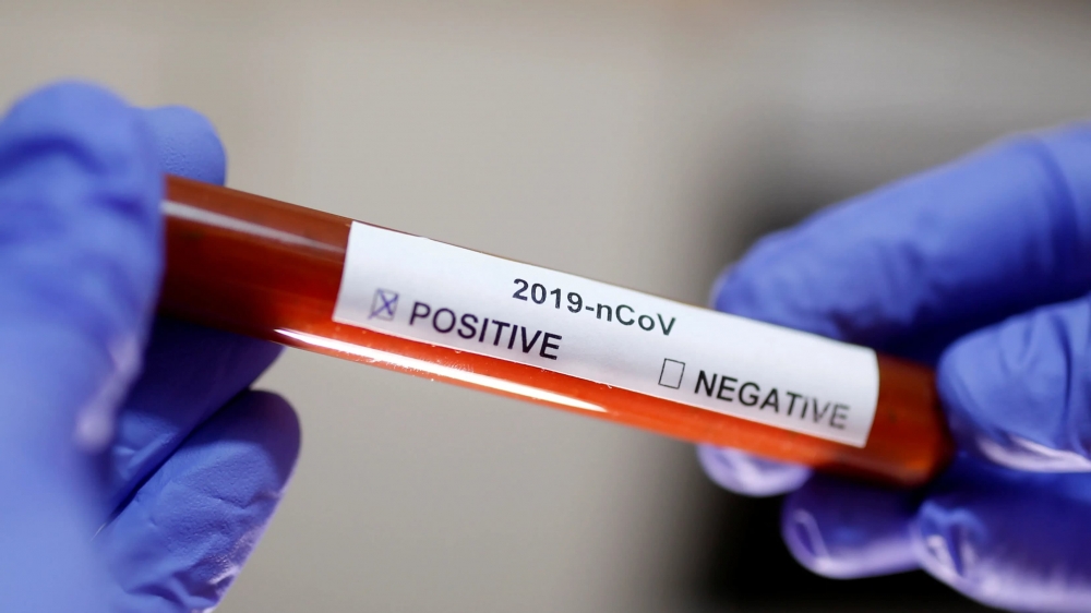 Çində ardıcıl üçüncü gün koronavirusa rekord yoluxma QEYDƏ ALINIB 