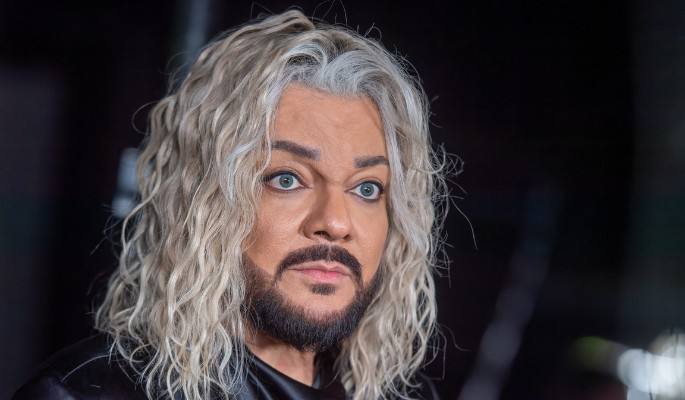 3 milyonluq plastik əməliyyatdan sonra Kirkorov ÜZƏ ÇIXDI - FOTO