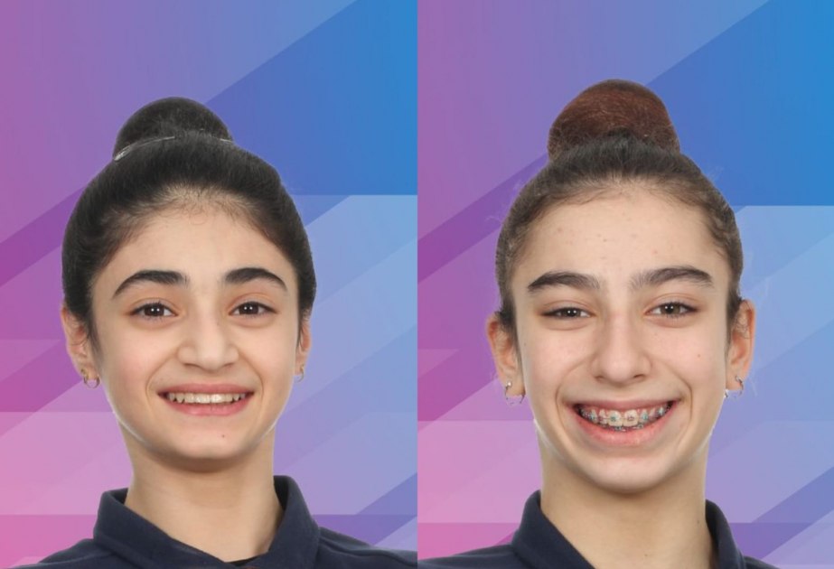 Gimnastlarımız Almaniyada 2 medal qazandılar Gimnastlarımız Almaniyada 2 medal qazandılar