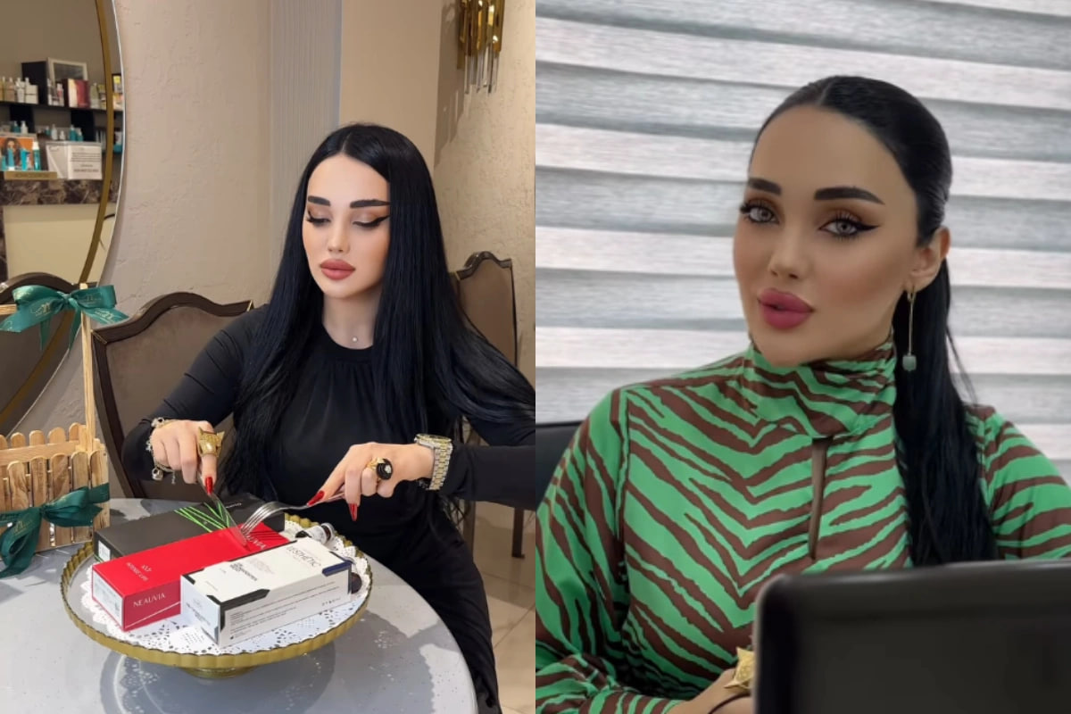 Bakıda botoks etdirən qız botulizmə YOLUXDU - FOTO