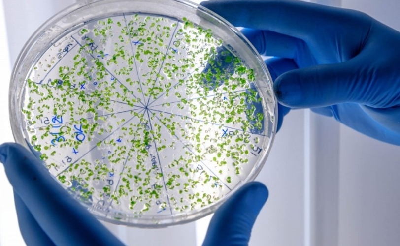 Dünyada yeni virus təhlükəsi- Fransada fövqəladə vəziyyət elan olundu