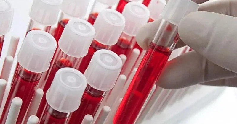 Ən ağıllı insanlar bu qan qrupundan olurlar – Yapon alimlərinin araşdırması