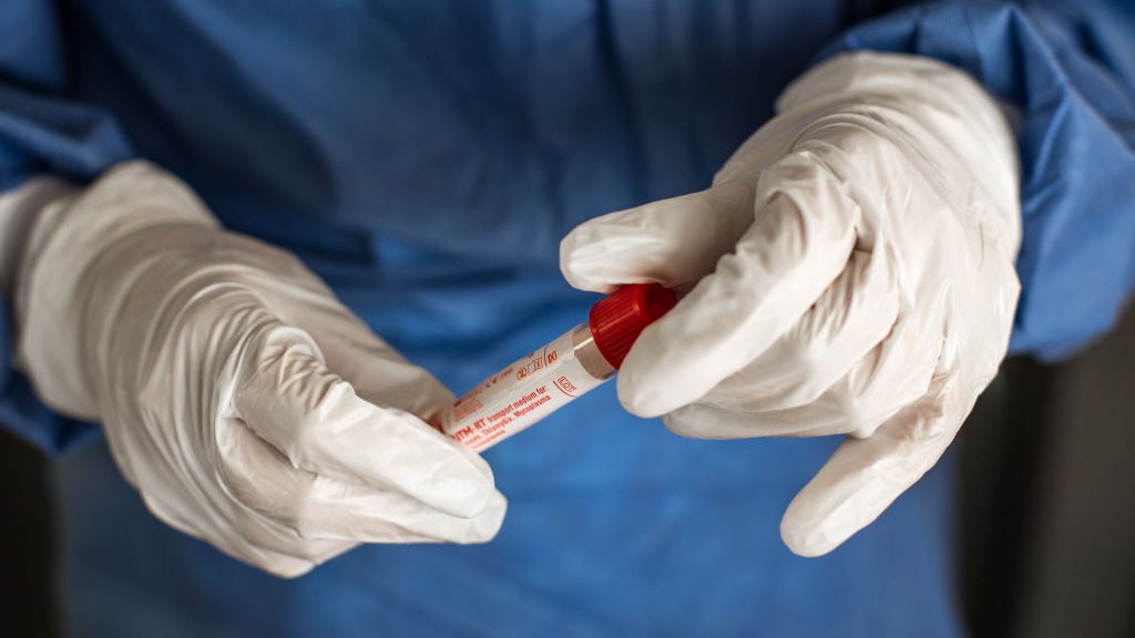 Koronavirus yenidən baş qaldırdı – Yoluxmalar sürətlə ARTIR