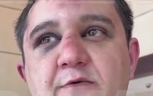 Erməni bloger: "Çeçenlər mənim qulaqlarımı tapançanın dəstəyi ilə sındırdılar"