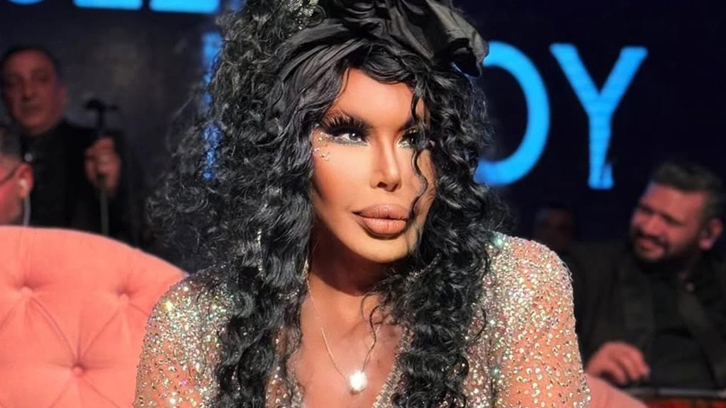 Bülent Ersoyun "dodaq uçuqladan" sərvəti ORTAYA ÇIXDI