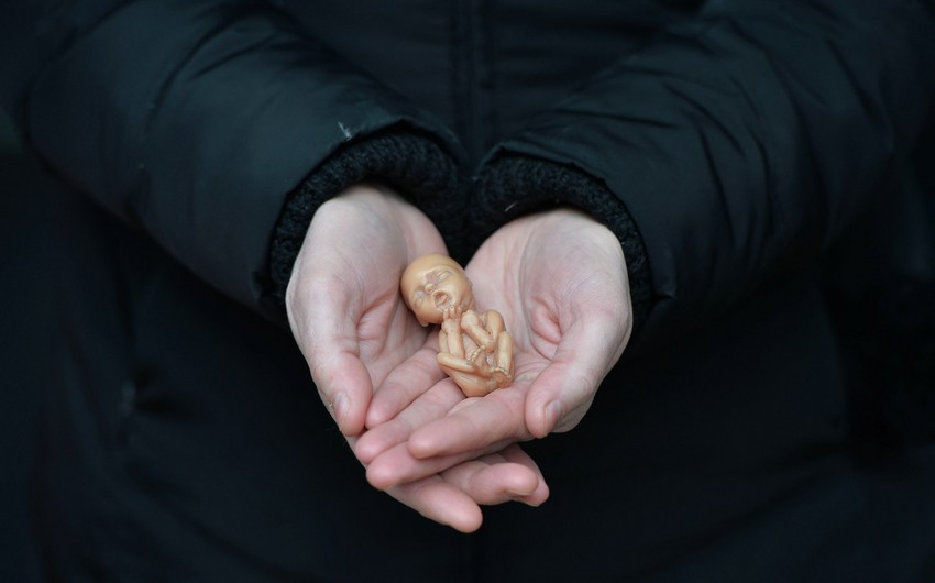 Qanunsuz aborta görə cəzalar SƏRTLƏŞDİRİLİR
