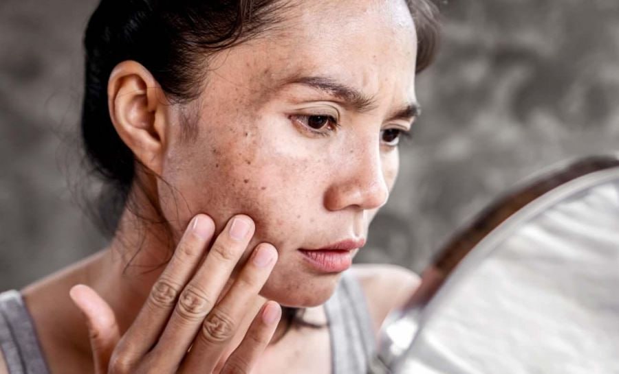 Dermatoloqdan xəbərdarlıq: Günəş yanığına qarşı bu addımları atın Dermatoloqdan xəbərdarlıq: Günəş yanığına qarşı bu addımları atın