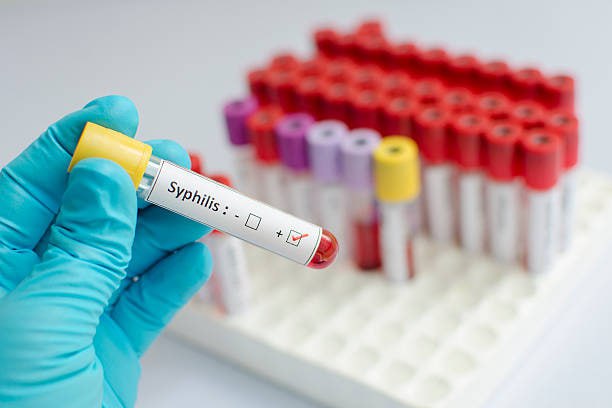 Azərbaycanda 24 uşaq sifilisə necə YOLUXUB? - SENSASİON AÇIQLAMA Azərbaycanda 24 uşaq sifilisə necə YOLUXUB? - SENSASİON AÇIQLAMA