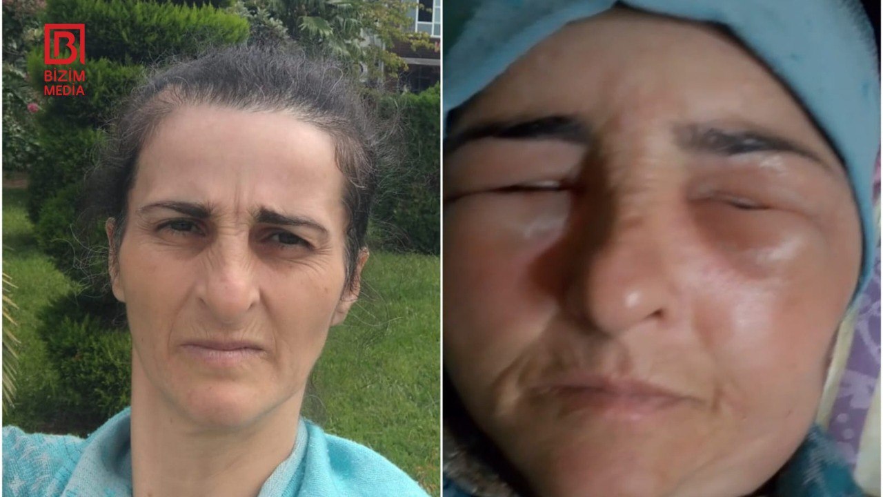 Lənkəranda qonşular arasında dava: Fiziki qüsurlu qadın xəsarət aldı – FOTO Lənkəranda qonşular arasında dava: Fiziki qüsurlu qadın xəsarət aldı – FOTO