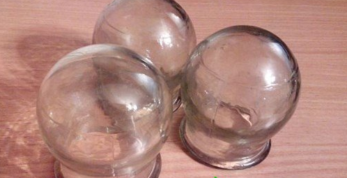Bakıda belinə banka qoyulan qadın həyatını itirib