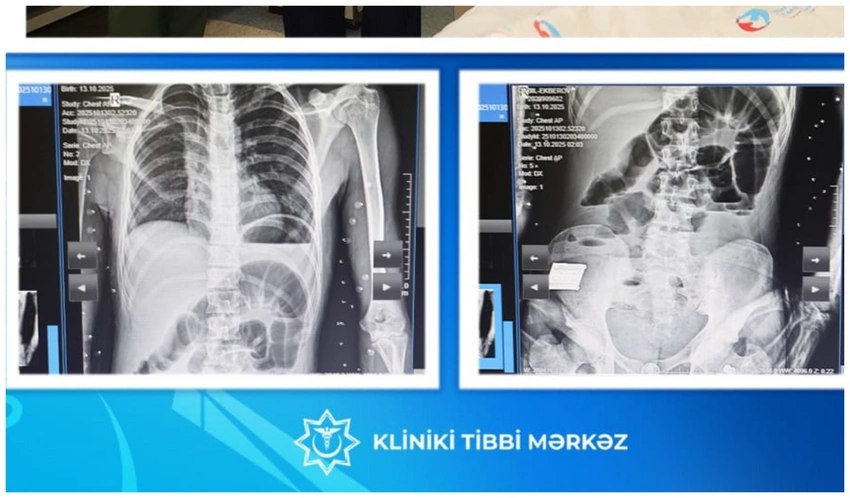 Bakıda 17 yaşlı yeniyetmə taxta UDDU – FOTO