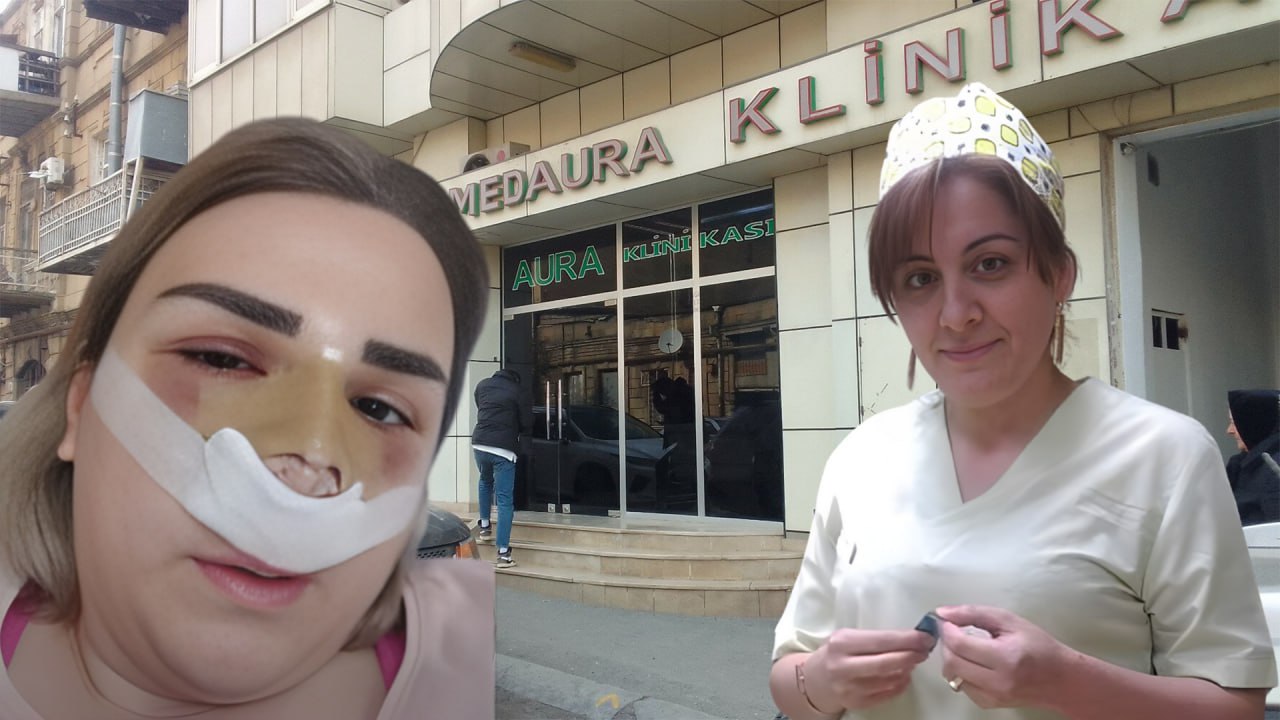 Ölüm saçan “MedAura” klinikası - Uğursuz əməliyyatlara səbəb olan Nigar Məhəmmədova iş başındadır? - ARAŞDIRMA