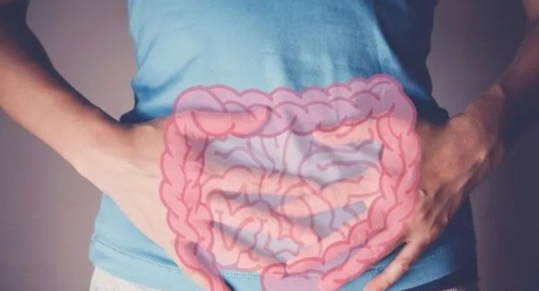 Adı çəkilən məhsullar bağırsaq xərçəngi riskini 17 faiz azaldır Adı çəkilən məhsullar bağırsaq xərçəngi riskini 17 faiz azaldır