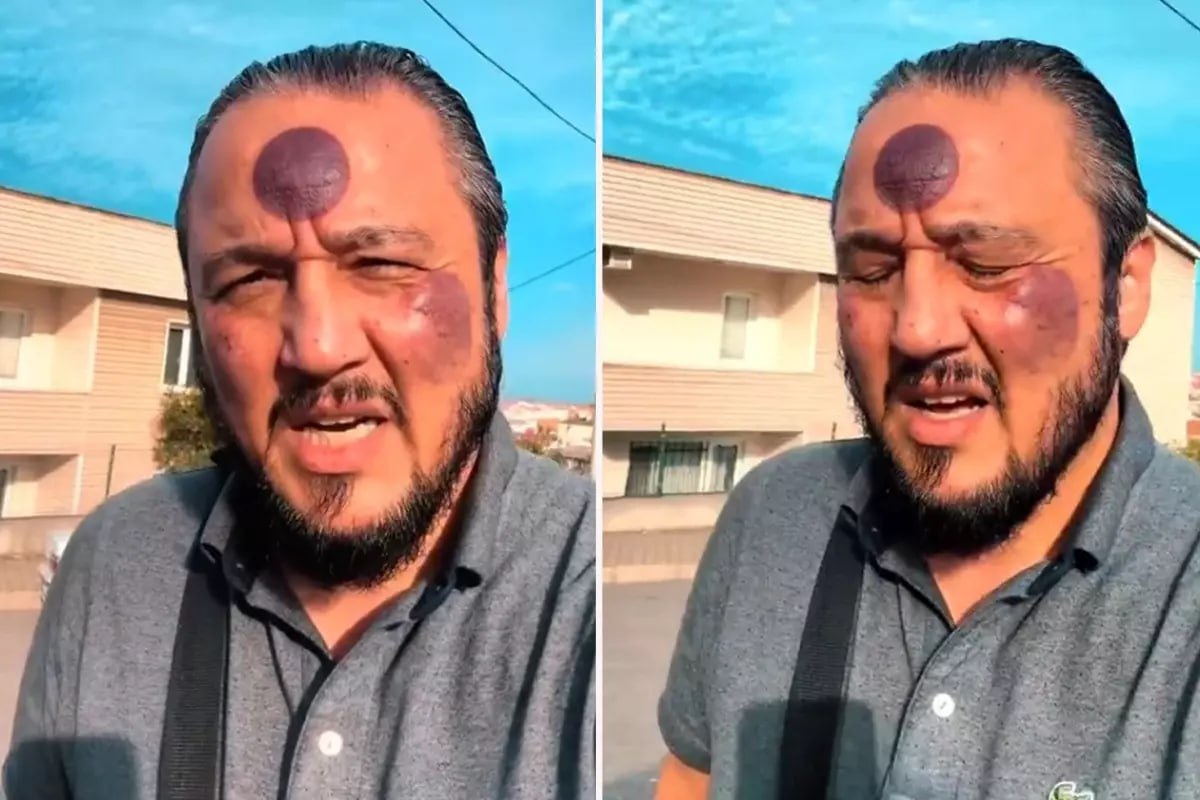 Üzünə hicama etdirən kişi görün nə HALA düşdü – VİDEO