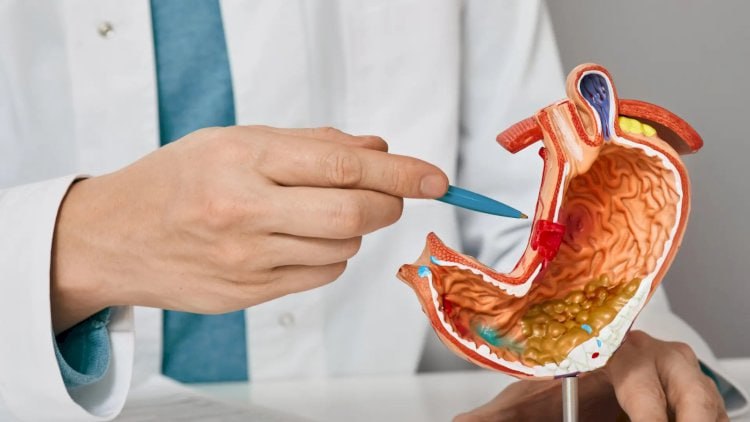 Mədəkiçiltmə əməliyyatı etdirənlərə XƏBƏRDARLIQ Mədəkiçiltmə əməliyyatı etdirənlərə XƏBƏRDARLIQ