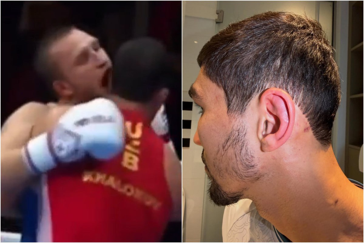 Rusiyalı məşqçi rəqibinin qulağını DİŞLƏDİ Rusiyalı məşqçi rəqibinin qulağını DİŞLƏDİ