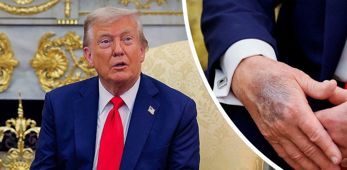 Tramp etiraf etdi: Əlini makiyaj edir &ndash; FOTO