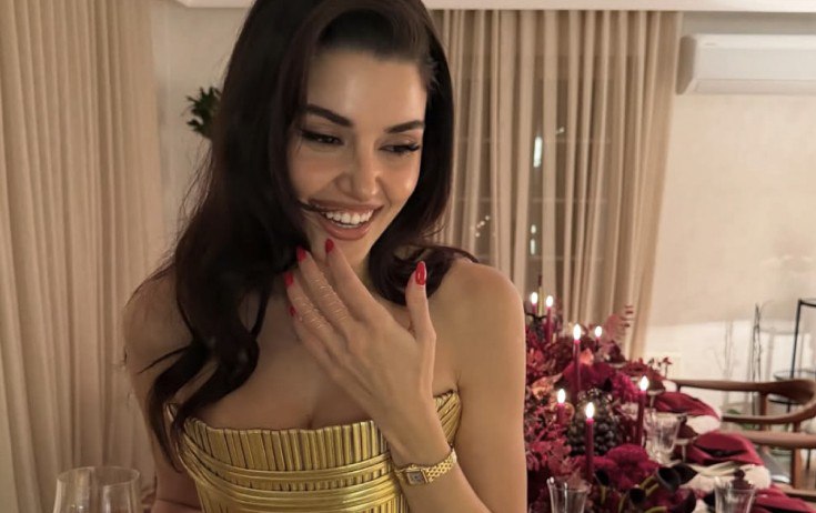 Qolundakı saatın 1,6 milyon qiyməti var - FOTO