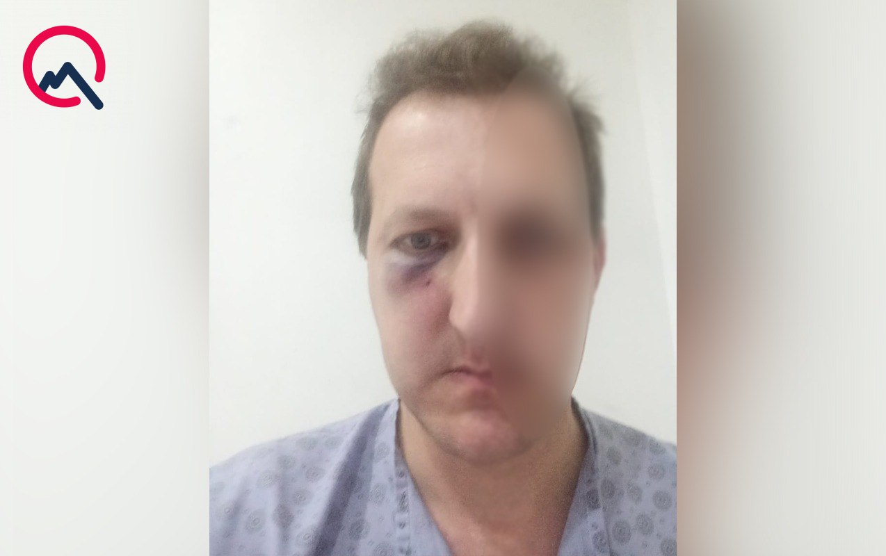 Xalq artistinin oğlu DÖYÜLDÜ