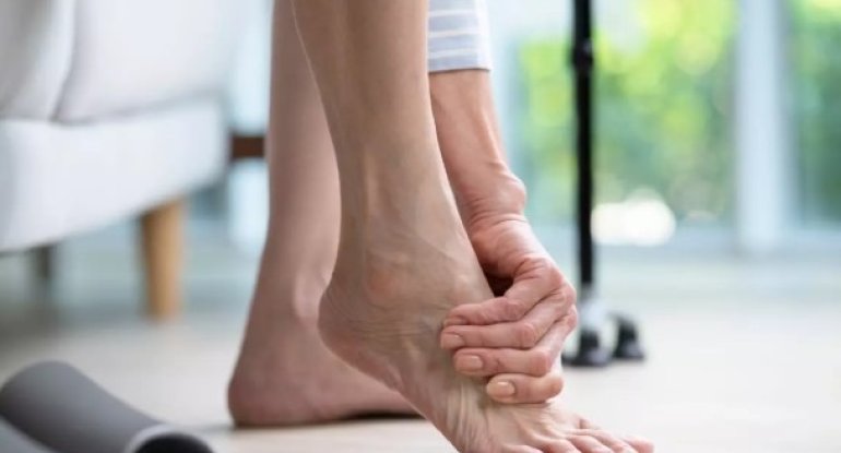 Ayaqlarda keyimə niyə yaranır?