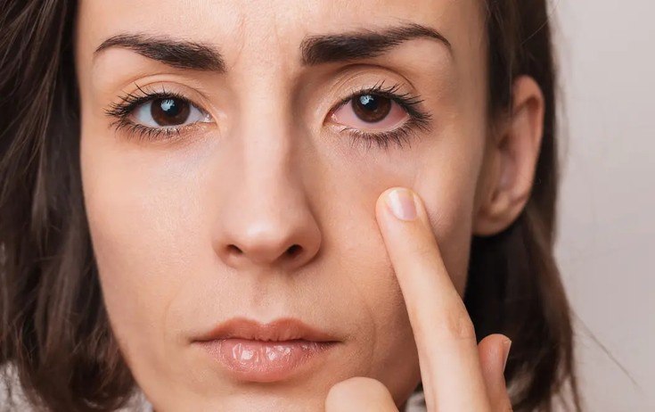 Telefonla çox oynayanların gözü TƏHLÜKƏDƏDİR