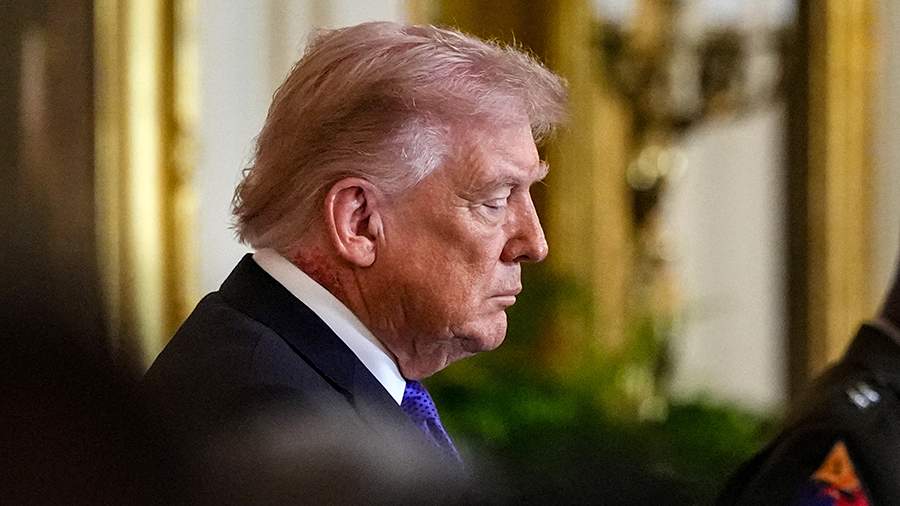 Trampın boynundakı qızartı müzakirə yaratdı – Ağ Ev açıqlama verdi Trampın boynundakı qızartı müzakirə yaratdı – Ağ Ev açıqlama verdi