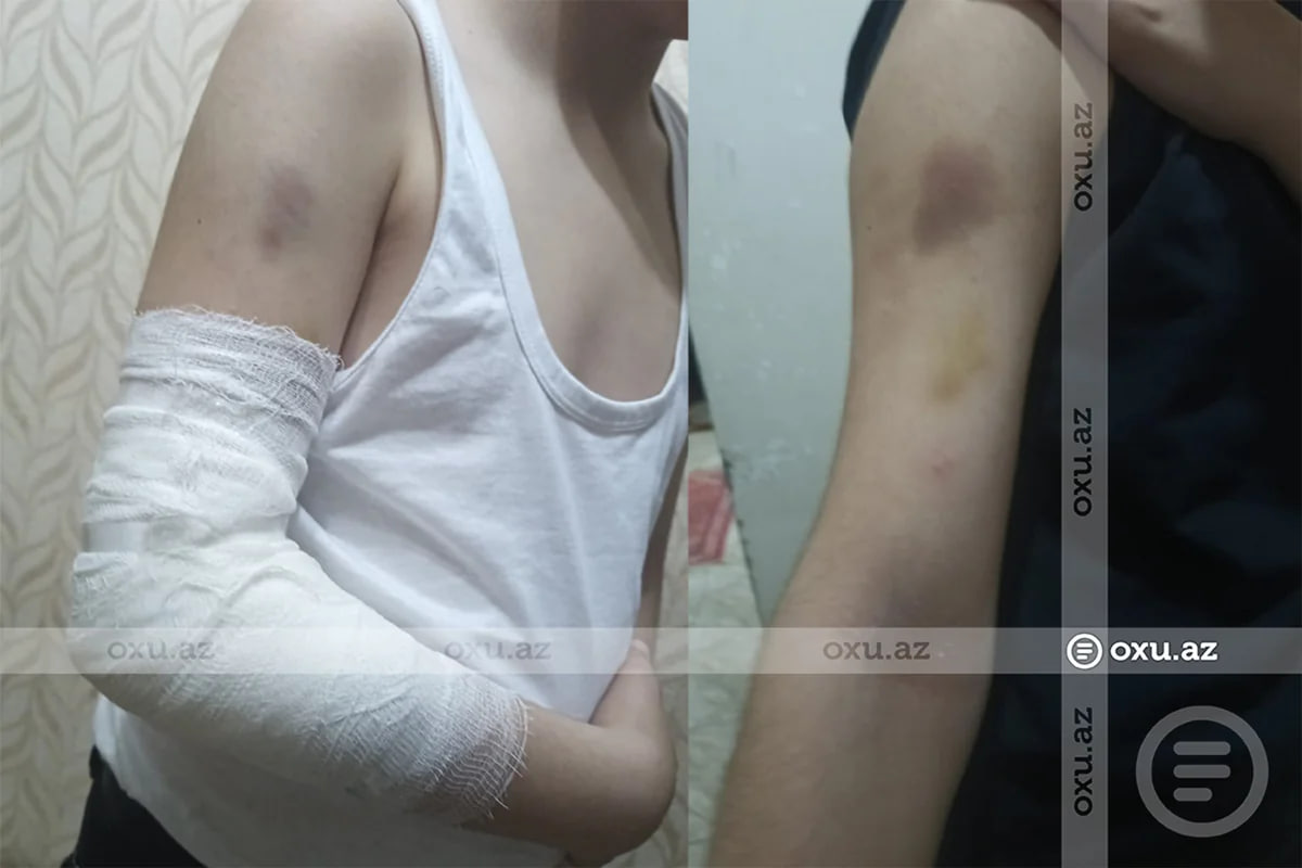 Bakıda məktəbli sinif yoldaşı tərəfindən döyüldü: Kamera niyə işləməyib? - İDDİA - FOTO