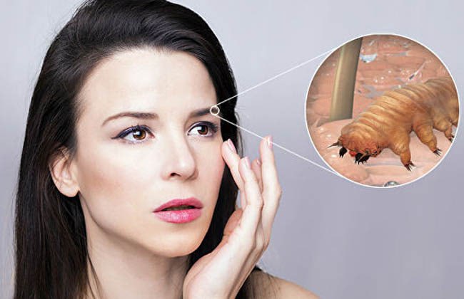 Sinir sistemini məhv edən HƏŞƏRAT - Havalar istiləşdikcə artırlar Sinir sistemini məhv edən HƏŞƏRAT - Havalar istiləşdikcə artırlar