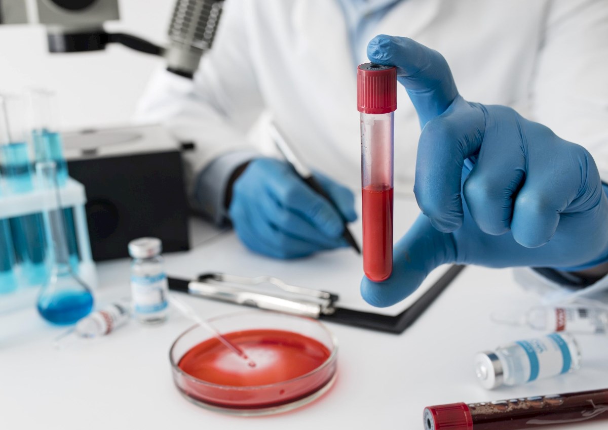 Ən uzunömürlü qan qrupu açıqlandı