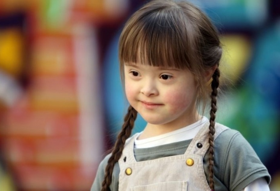 Naxçıvanda daun sindromlu uşaqların sayı açıqlanıb Naxçıvanda daun sindromlu uşaqların sayı açıqlanıb