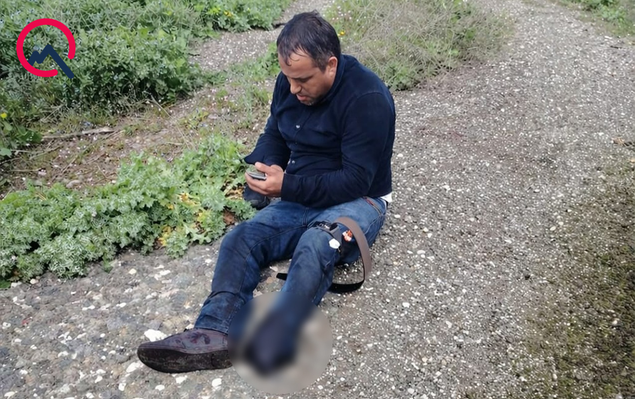 Ağdamda minaya düşən Ceyhunun - Fotosu