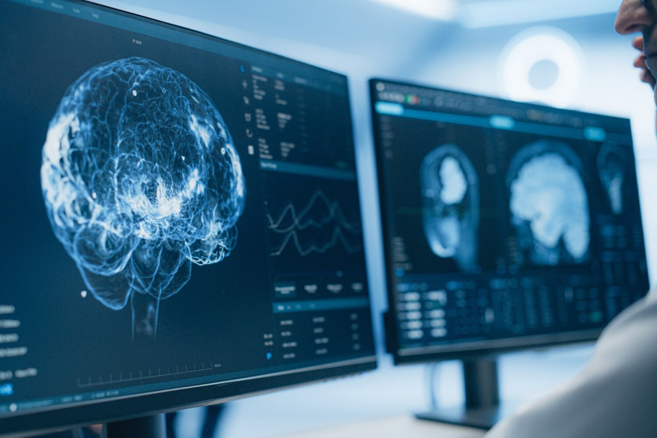 Alimlərdən Alzheimerlə mübarizə üçün qeyri-adi ÜSUL Alimlərdən Alzheimerlə mübarizə üçün qeyri-adi ÜSUL