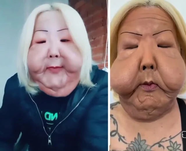 Gözəl olmaq istədi, tanınmaz hala düşdü &ndash; ŞOK FOTOLAR