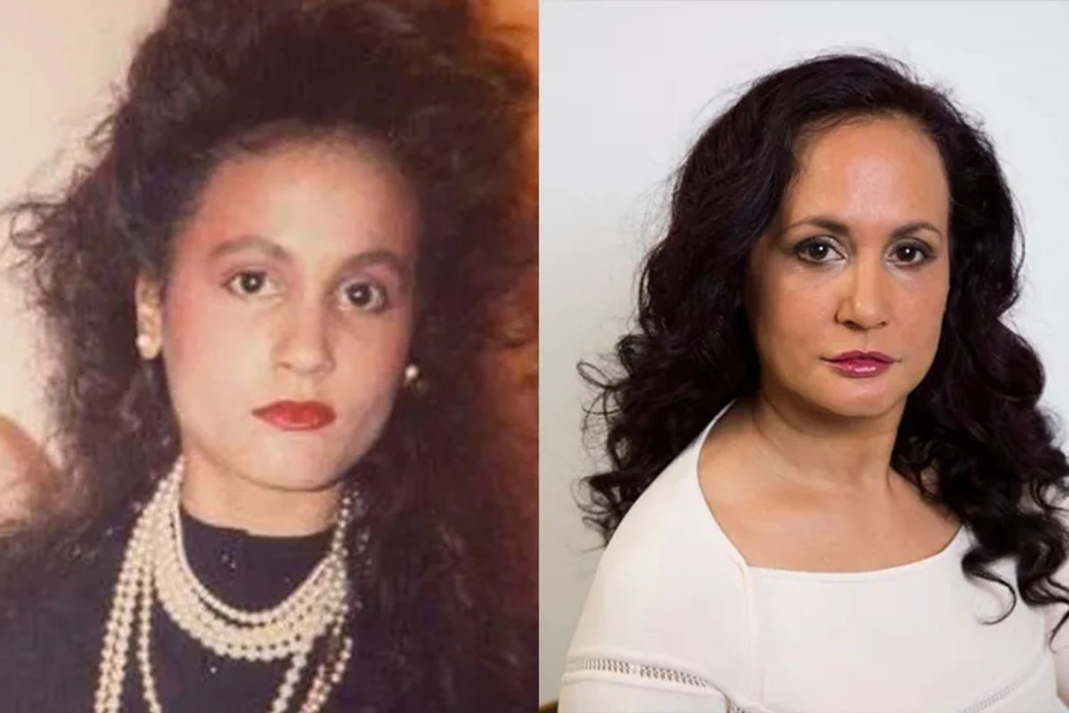 Üz dərisi qırışmasın deyə 49 ildir gülmür &ndash; FOTO