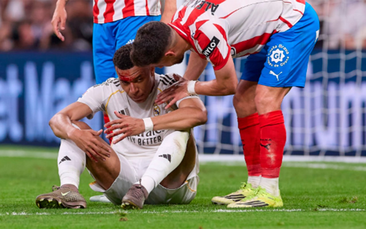 Mbappe zədəsinə görə məşqi buraxdı