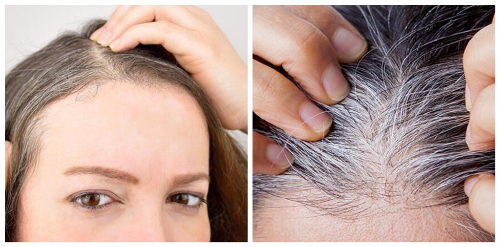 Ağ saçları yox edib yenidən çıxmasını əngəlləyən 9 TƏBİİ VASİTƏ Ağ saçları yox edib yenidən çıxmasını əngəlləyən 9 TƏBİİ VASİTƏ