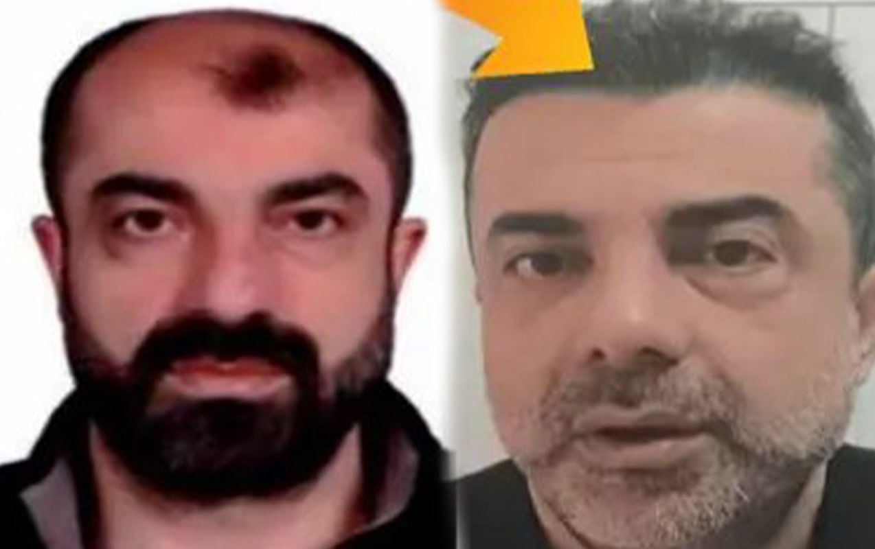 Estetik əməliyyatlarla 7 il gizlənə bildi &ndash; VİDEO