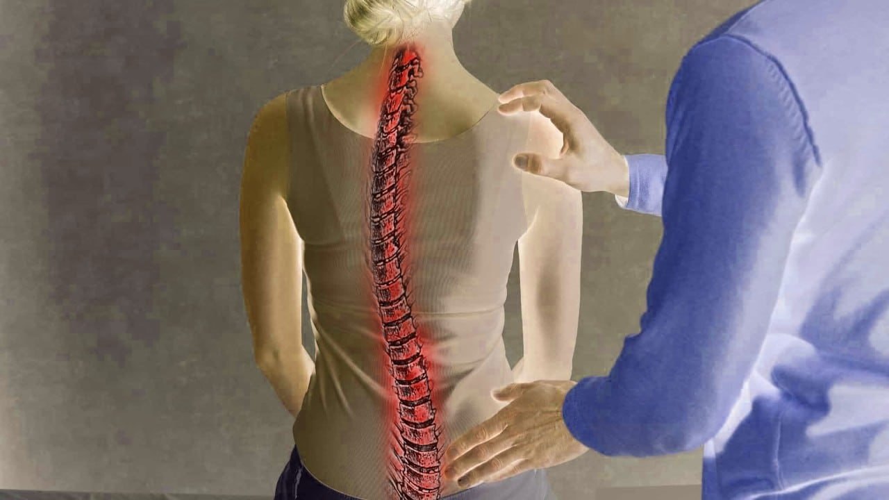 Yeniyetmələrdəki bu problem onurğa əyriliyinə səbəb OLA BİLƏR