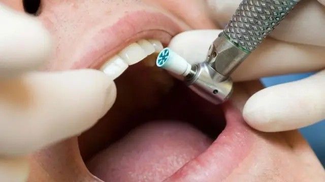 Diş müayinəsi həyatı bahasına başa gəldi: Komaya düşdü, əzalarını itirdi &ndash; FOTO